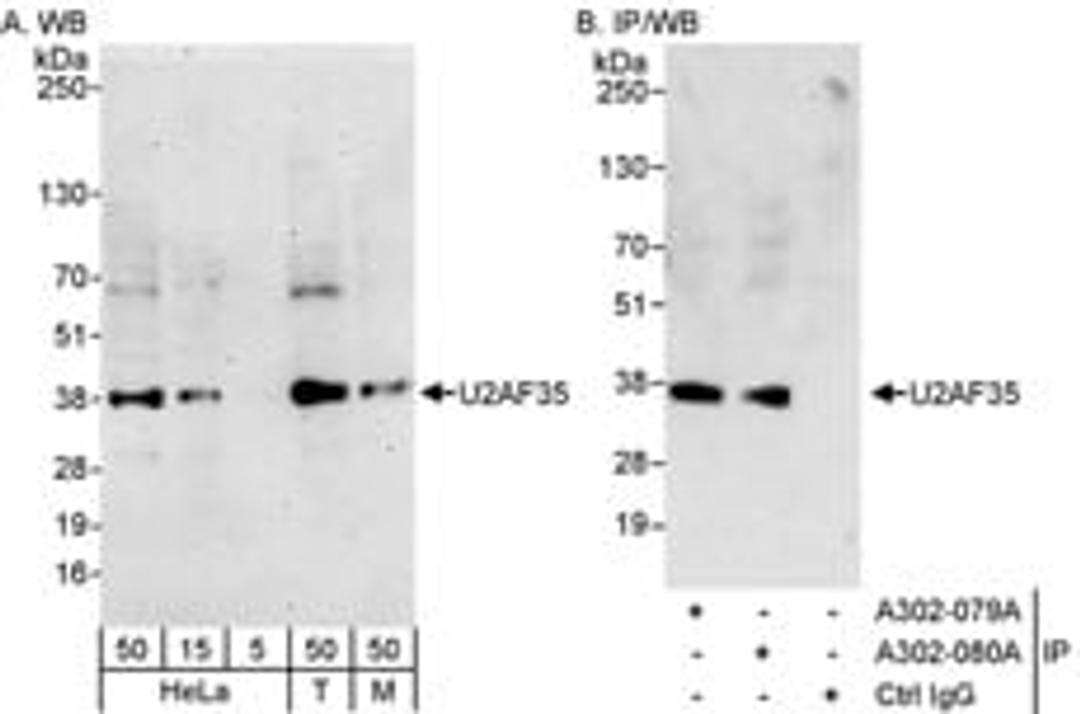 Detection of human and mouse U2AF35 by western blot (h&m) and immunoprecipitation (h).