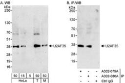 Detection of human and mouse U2AF35 by western blot (h&m) and immunoprecipitation (h).