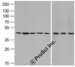 Western blot analysis of beta-Actin in A431, Daudi, HepG2, HL60, Jurkat, Human brain, Mouse lung, and Chicken liver lysate with beta-Actin antibody at 1 μg/mL.