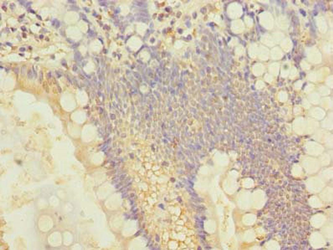 Immunohistochemistry of paraffin-embedded human small intestine tissue using CSB-PA021510LA01HU at dilution of 1:100