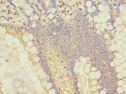 Immunohistochemistry of paraffin-embedded human small intestine tissue using CSB-PA021510LA01HU at dilution of 1:100