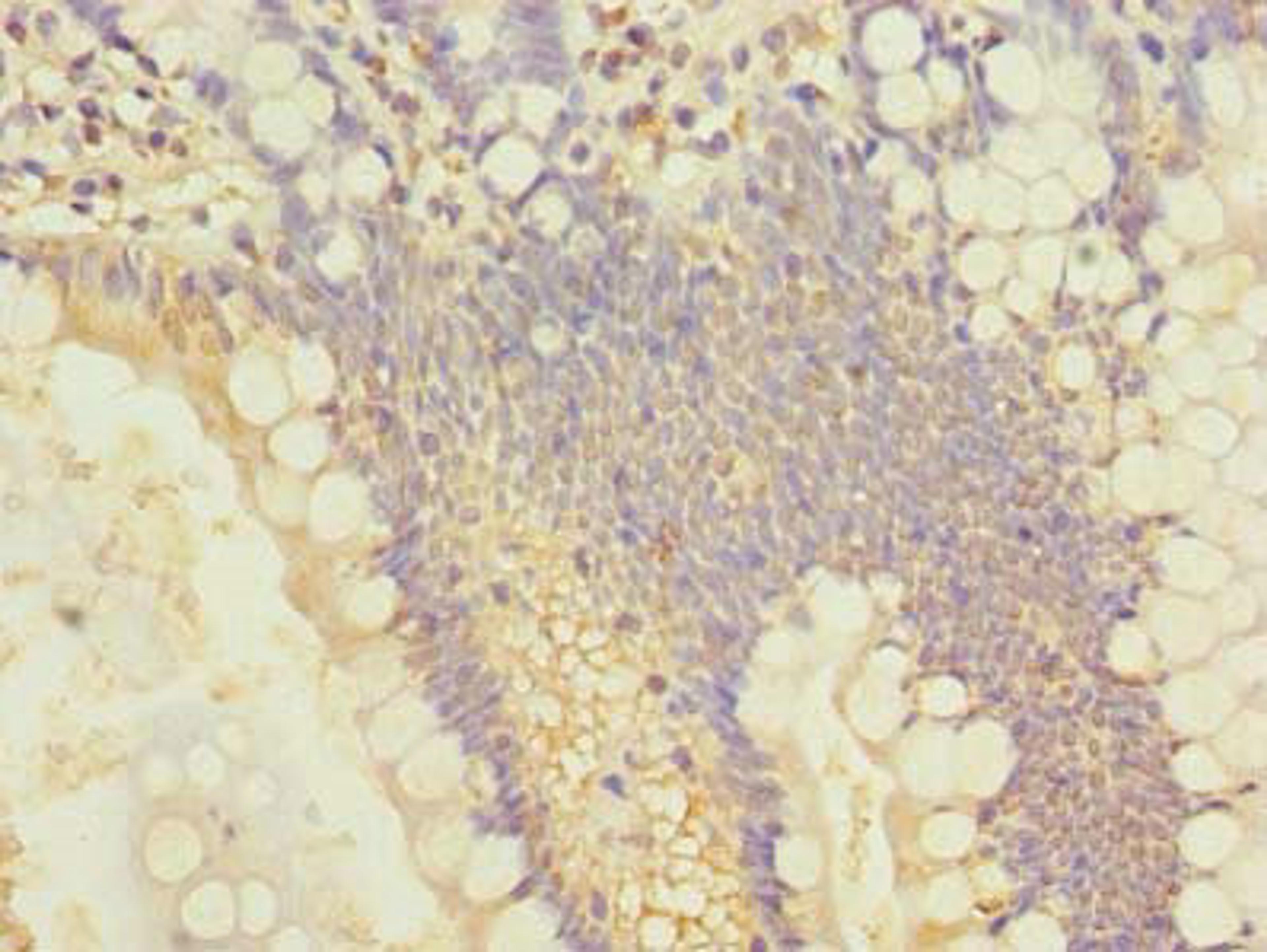 Immunohistochemistry of paraffin-embedded human small intestine tissue using CSB-PA021510LA01HU at dilution of 1:100