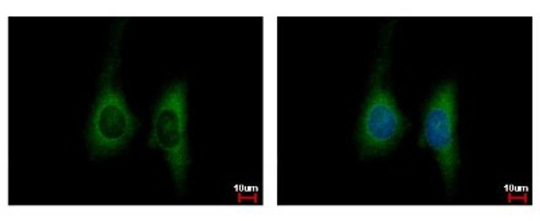 Immunocytochemistry/Immunofluorescence: KIR2DL4 Antibody [NBP2-17062] - Sample: HeLa cells were fixed in 4% paraformaldehyde at RT for 15 min. Green: KIR2DL4 protein stained by KIR2DL4 antibody diluted at 1:500. Blue: Hoechst 33342 staining.