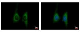 Immunocytochemistry/Immunofluorescence: KIR2DL4 Antibody [NBP2-17062] - Sample: HeLa cells were fixed in 4% paraformaldehyde at RT for 15 min. Green: KIR2DL4 protein stained by KIR2DL4 antibody diluted at 1:500. Blue: Hoechst 33342 staining.