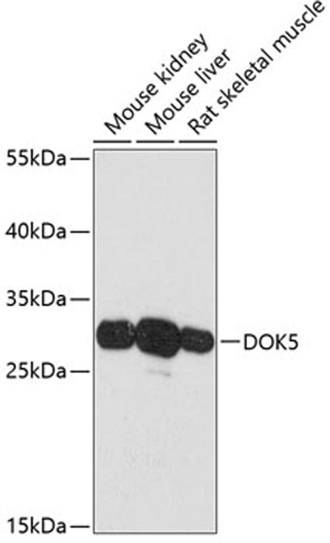 Western blot - DOK5 antibody (A13726)