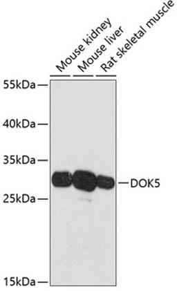 Western blot - DOK5 antibody (A13726)