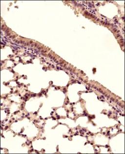 Immunohistochemistry-Paraffin: STING/TMEM173/MPYS Antibody [NBP2-24683] - IHC analysis of STING protein in formalin-fixed paraffin-embedded mouse lung tissue section using STING antibody at 1:150 dilution with detection employing HRP-conjugated secondary antibody. The signal was developed using DAB reagent and the nuclei were counterstained with hematoxylin. The antibody generated mainly a cytoplasmic staining in the bronchiolar and alveolar epithelial cells.