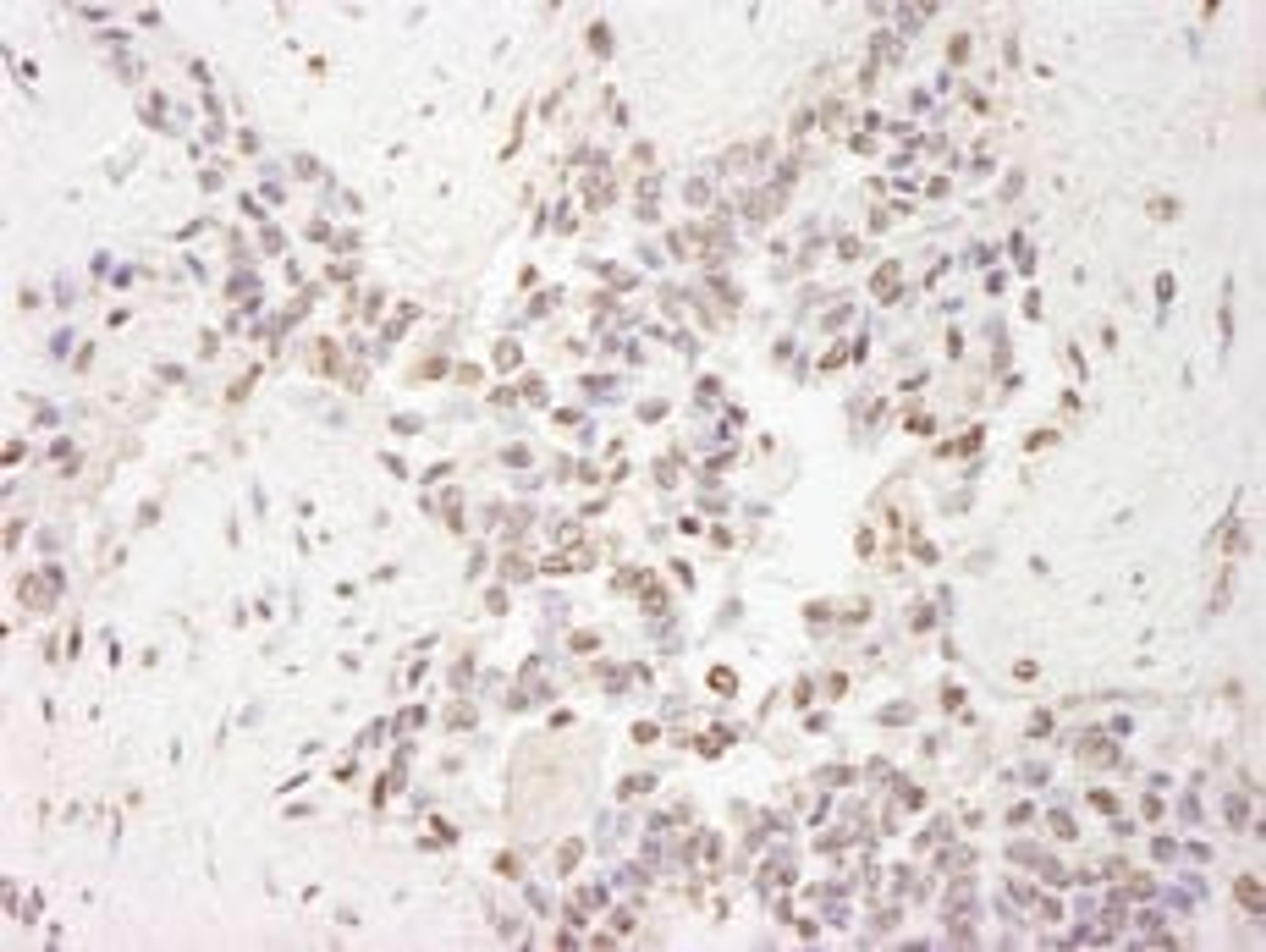 Detection of human MBD2 by immunohistochemistry.