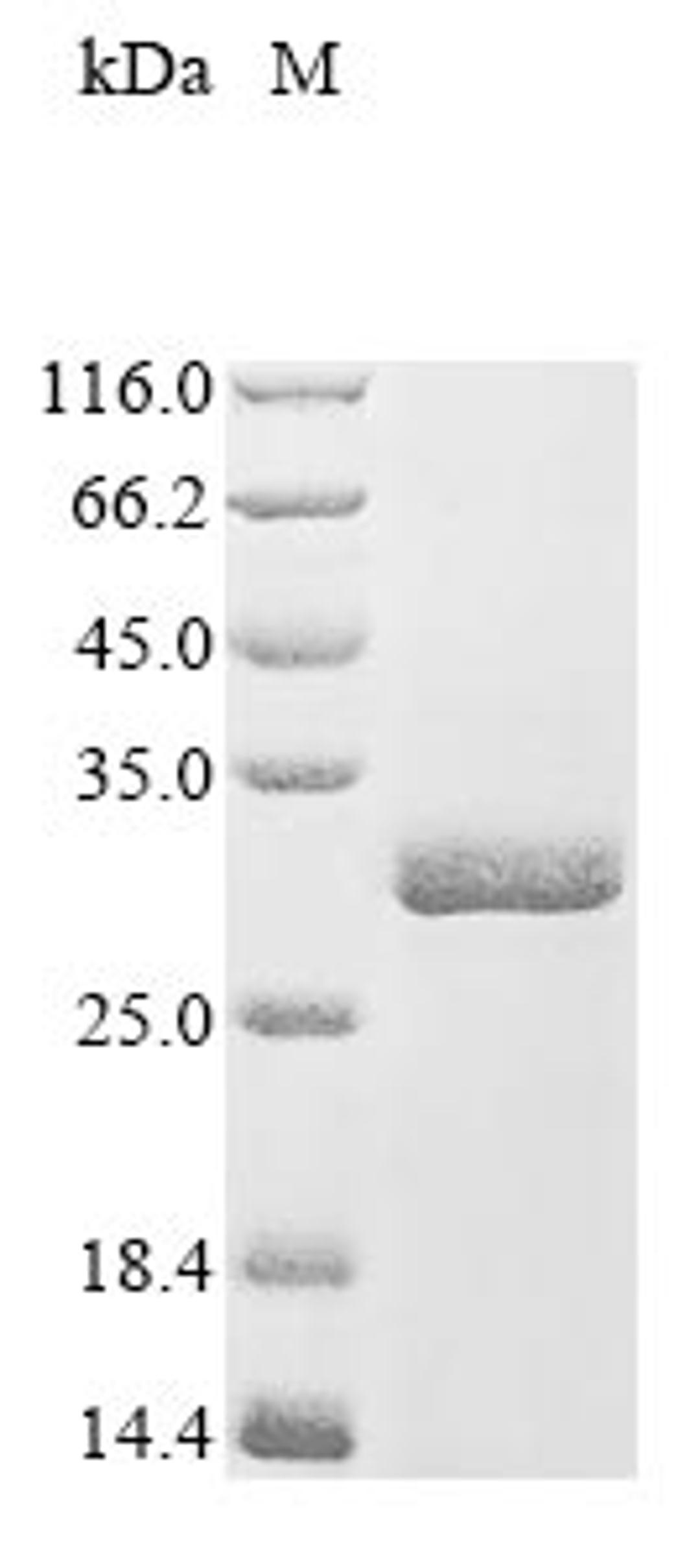 (Tris-Glycine gel) Discontinuous SDS-PAGE (reduced) with 5% enrichment gel and 15% separation gel.
