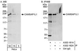 Detection of human CAMSAP1L1 by western blot and immunoprecipitation.