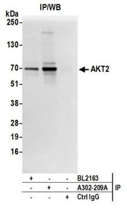 Detection of human AKT2 by western blot of immunoprecipitates.