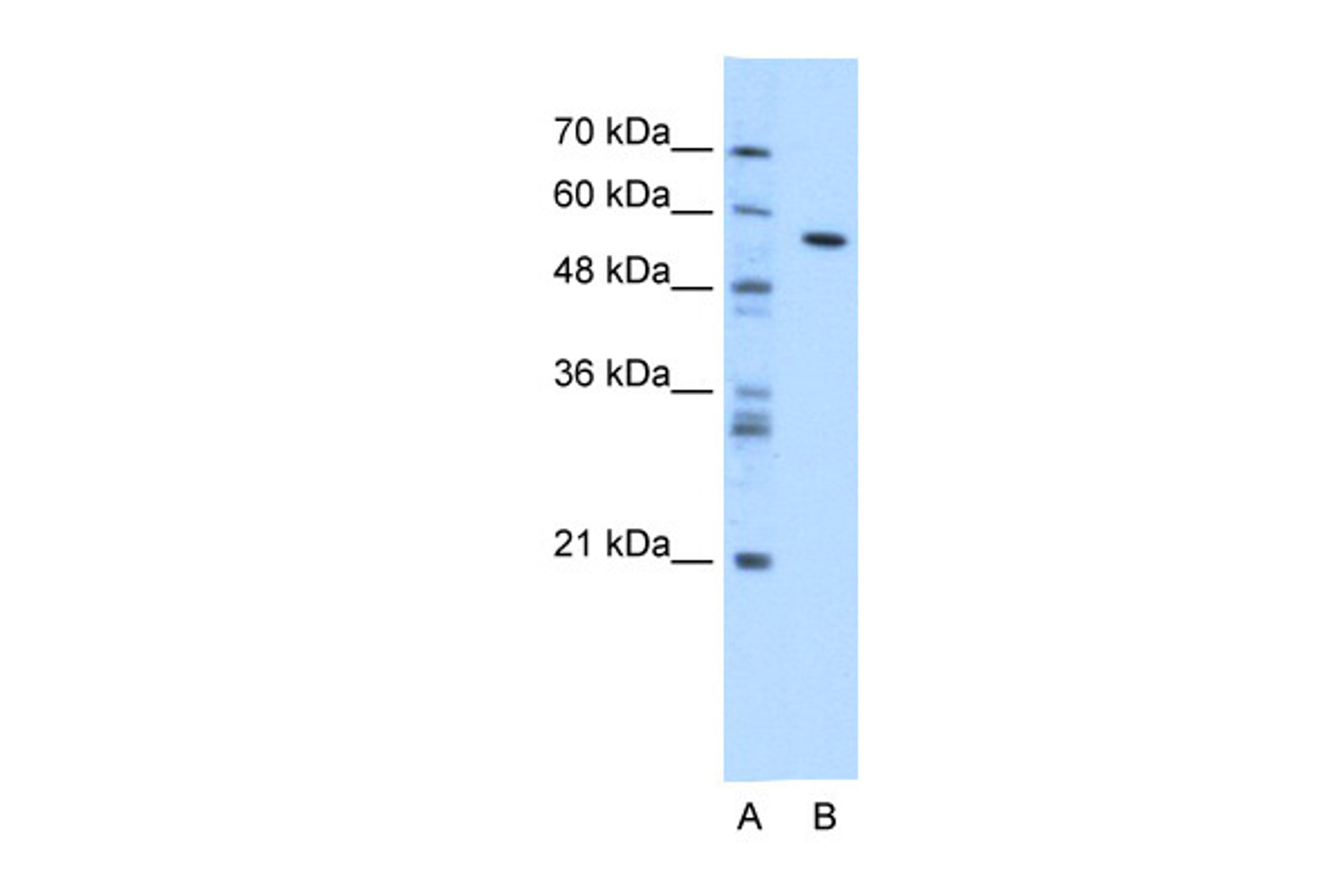 Antibody used in WB on Transfected 293T at 1.25 ug/ml.