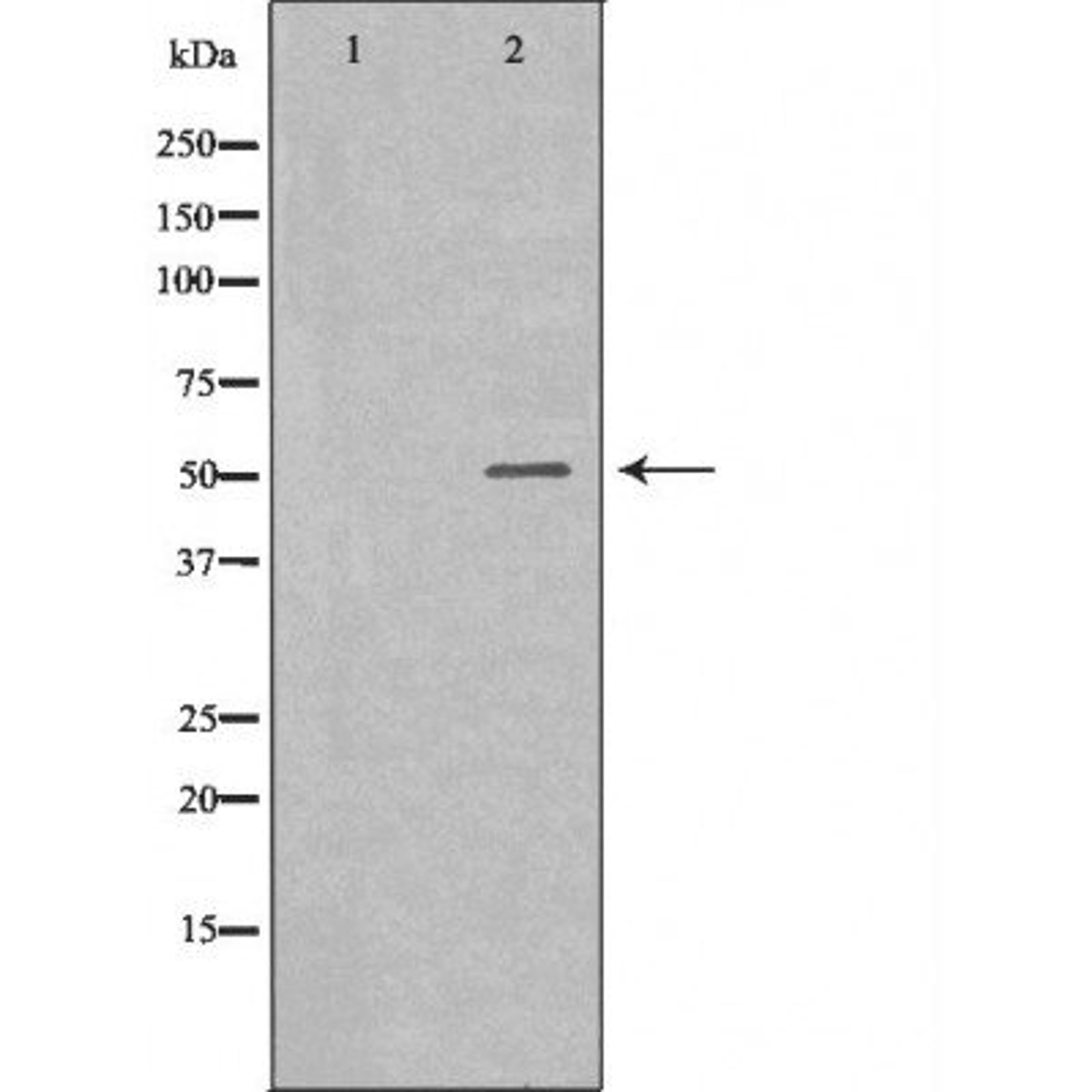 Western blot analysis of various cell lines using IL-6R antibody