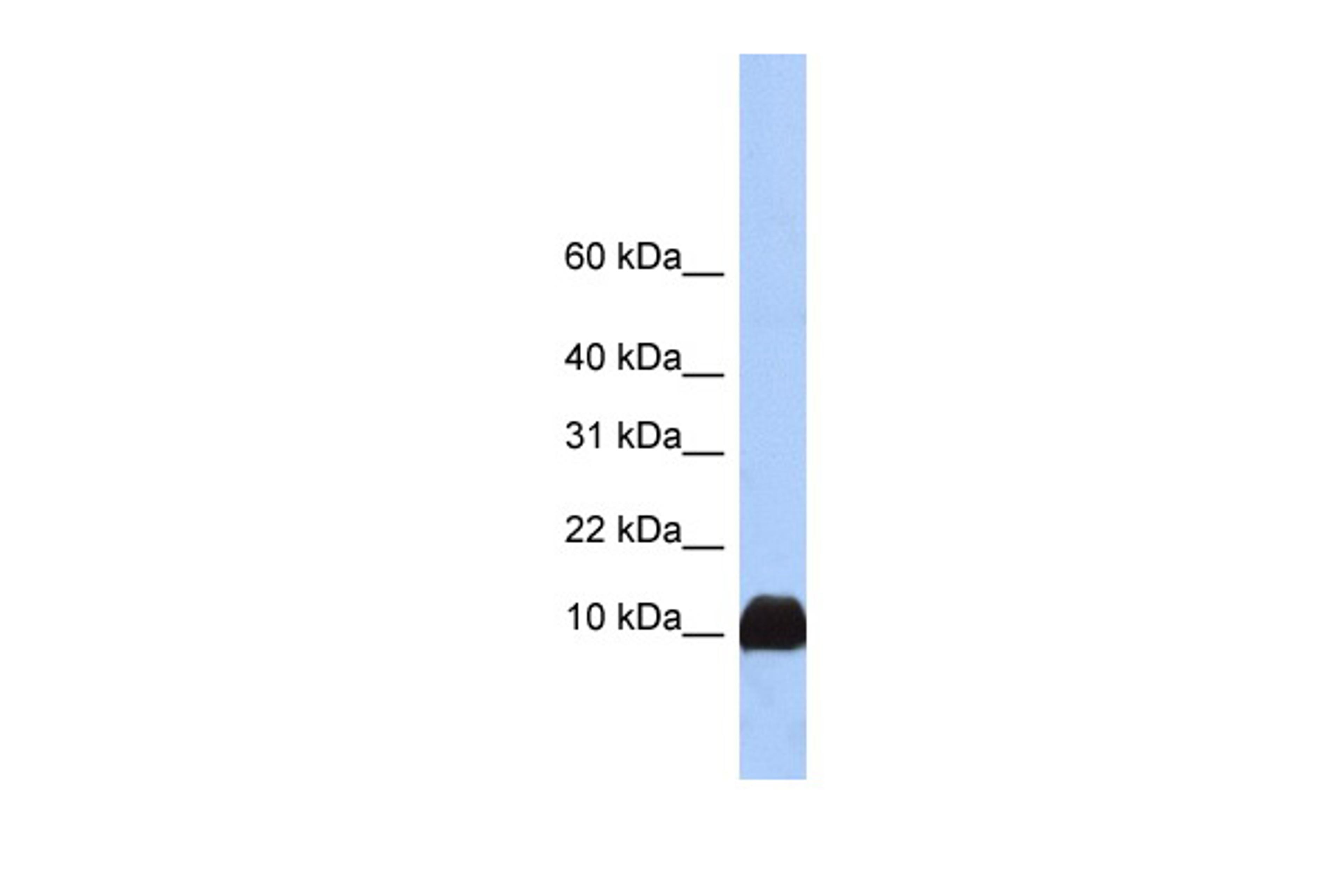 Antibody used in WB on Human Liver at 0.2-1 ug/ml.