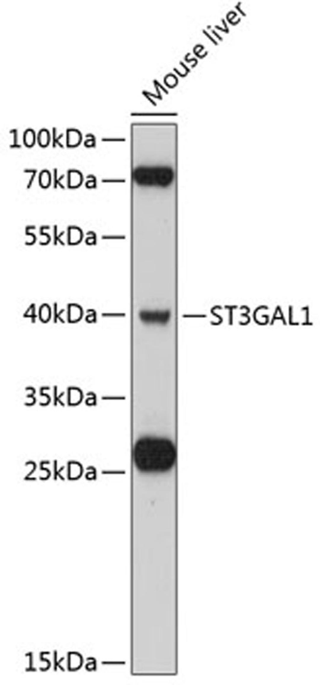 Western blot - ST3GAL1 antibody (A11616)