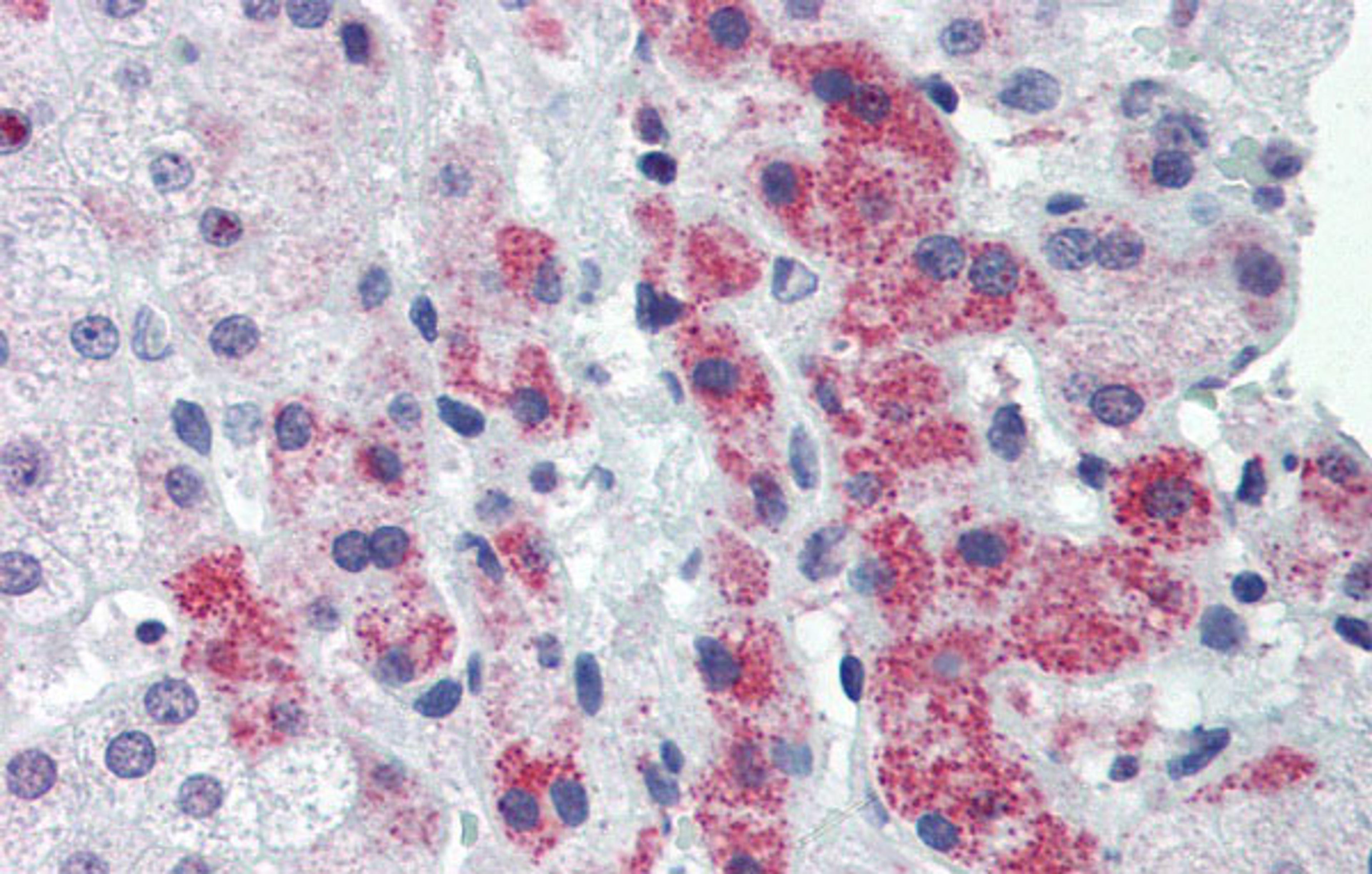 Antibody used in IHC on Human Liver at 5.0 ug/ml.