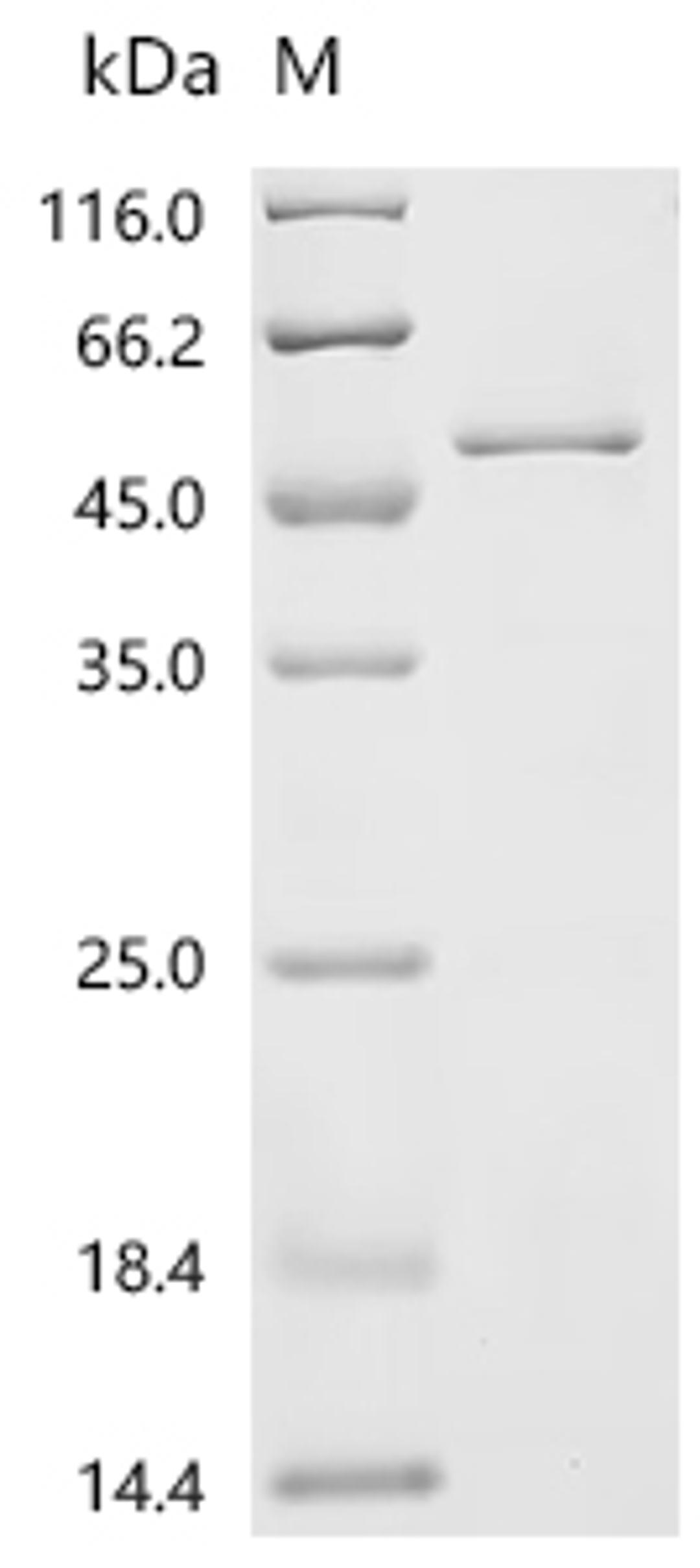 (Tris-Glycine gel) Discontinuous SDS-PAGE (reduced) with 5% enrichment gel and 15% separation gel.