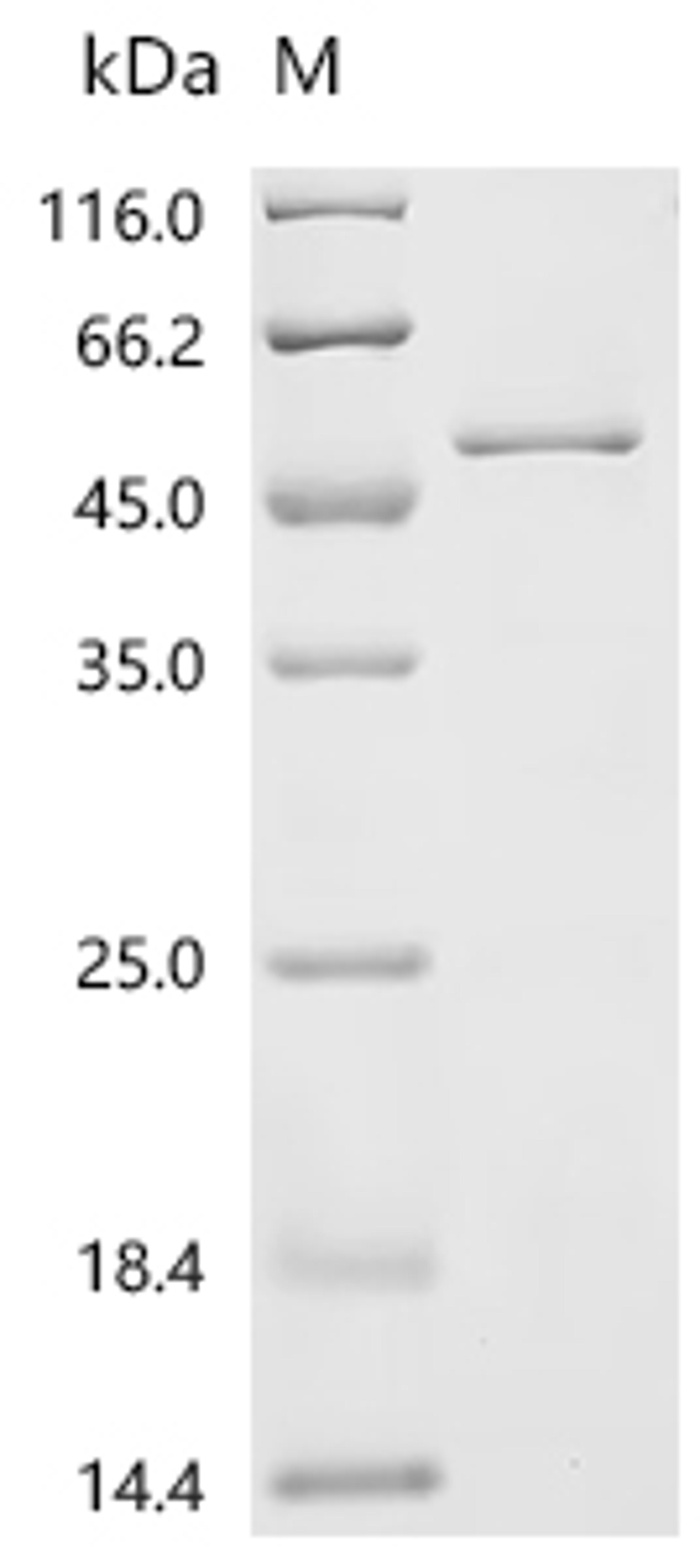 (Tris-Glycine gel) Discontinuous SDS-PAGE (reduced) with 5% enrichment gel and 15% separation gel.