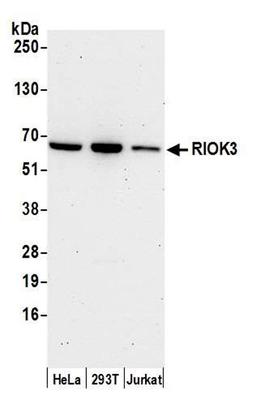 Detection of human RIOK3 by WB.