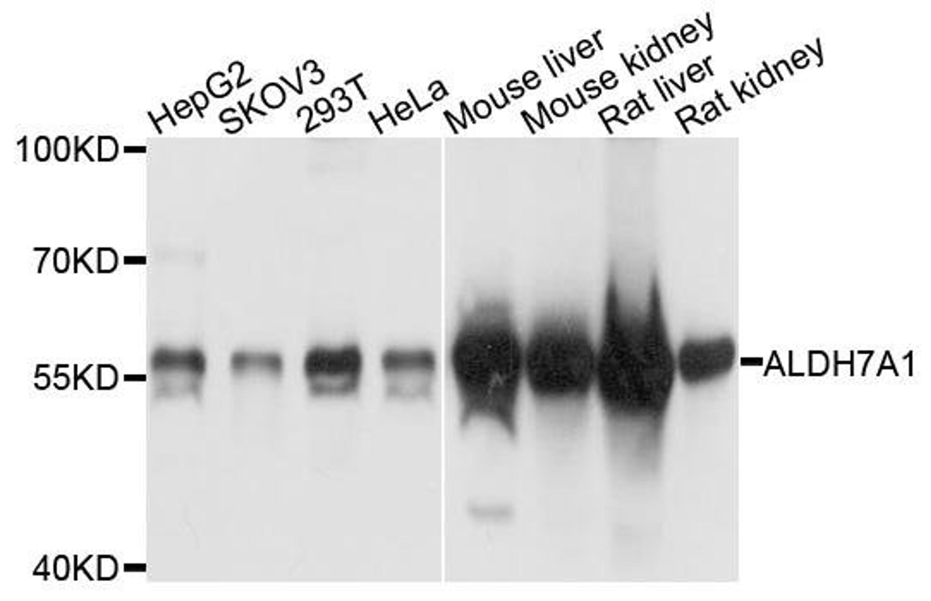 Western blot analysis of extracts of various cells using ALDH7A1 antibody