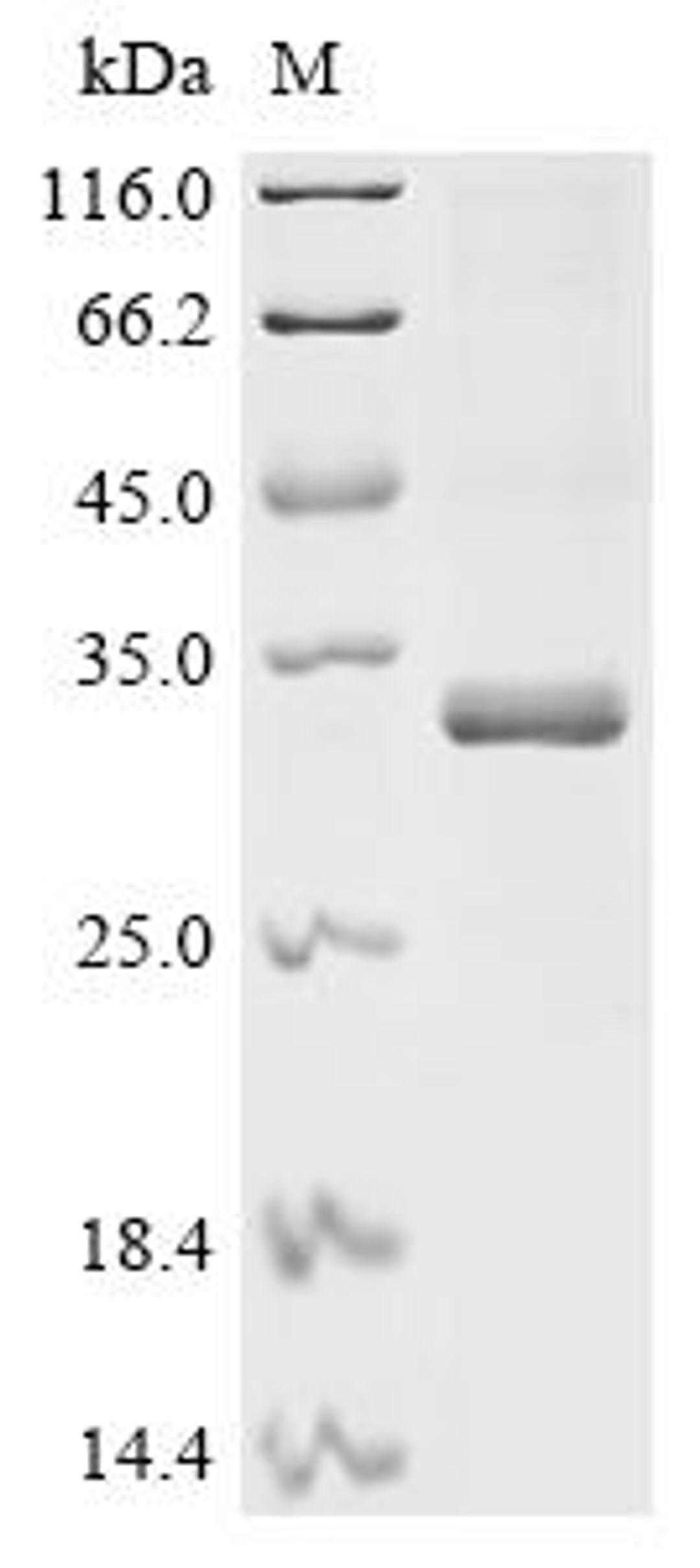 (Tris-Glycine gel) Discontinuous SDS-PAGE (reduced) with 5% enrichment gel and 15% separation gel.