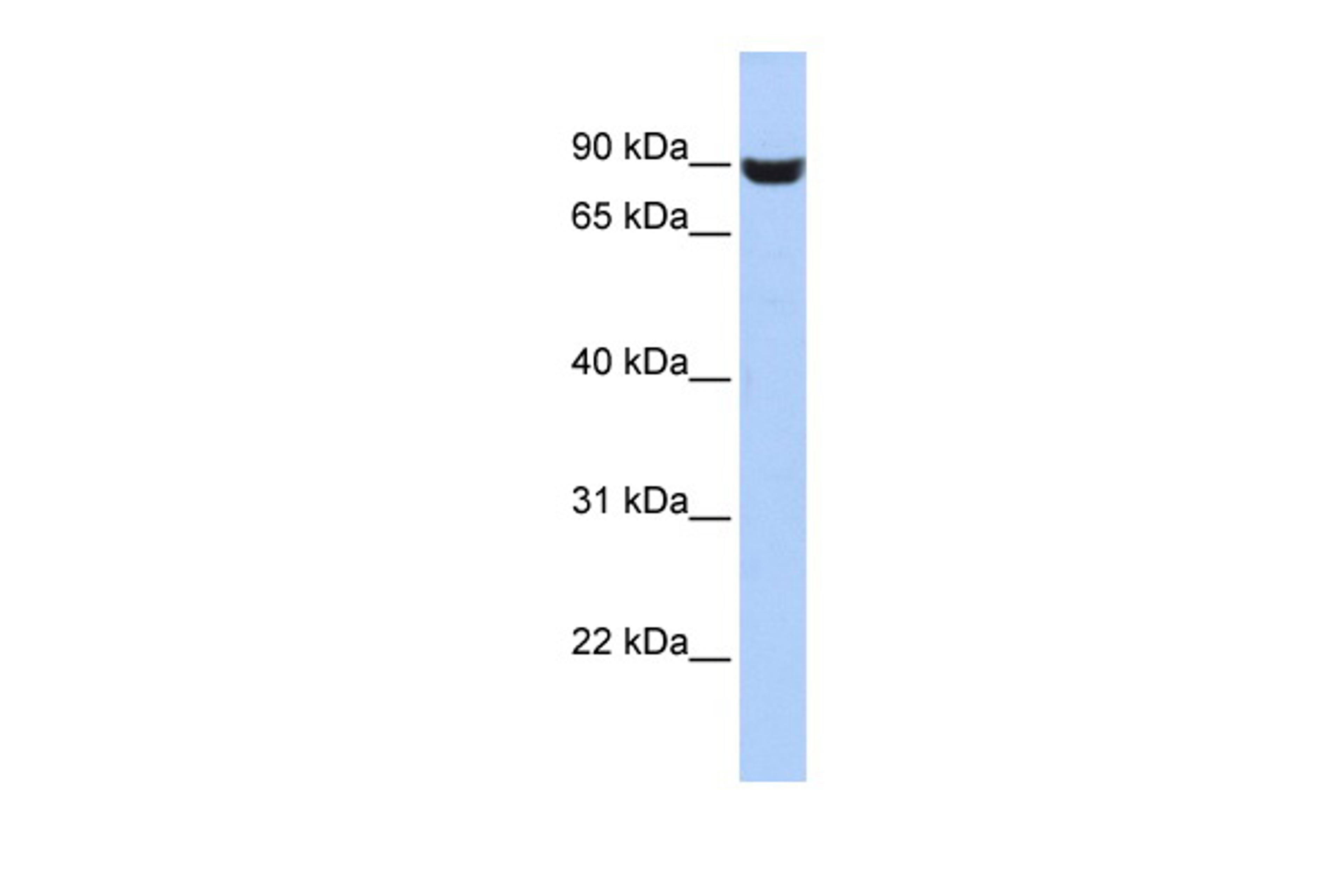 Antibody used in WB on Human HepG2 at 0.2-1 ug/ml.