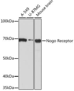 Western blot - Nogo Receptor Rabbit mAb (A3952)