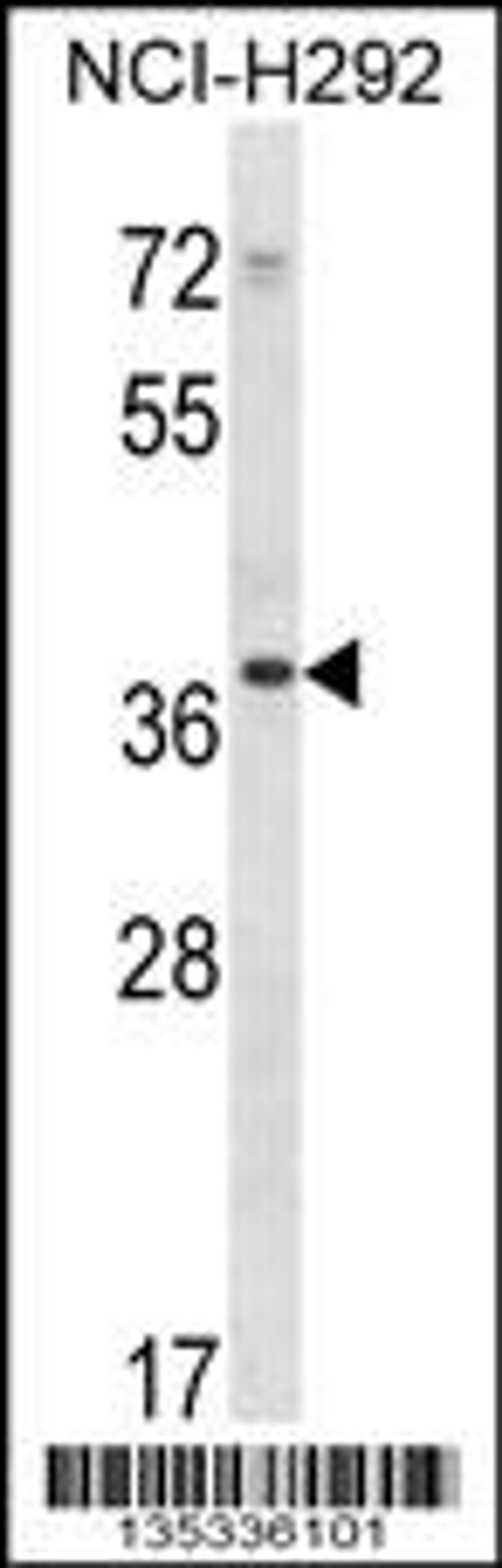 Western blot analysis in NCI-H292 cell line lysates (35ug/lane).