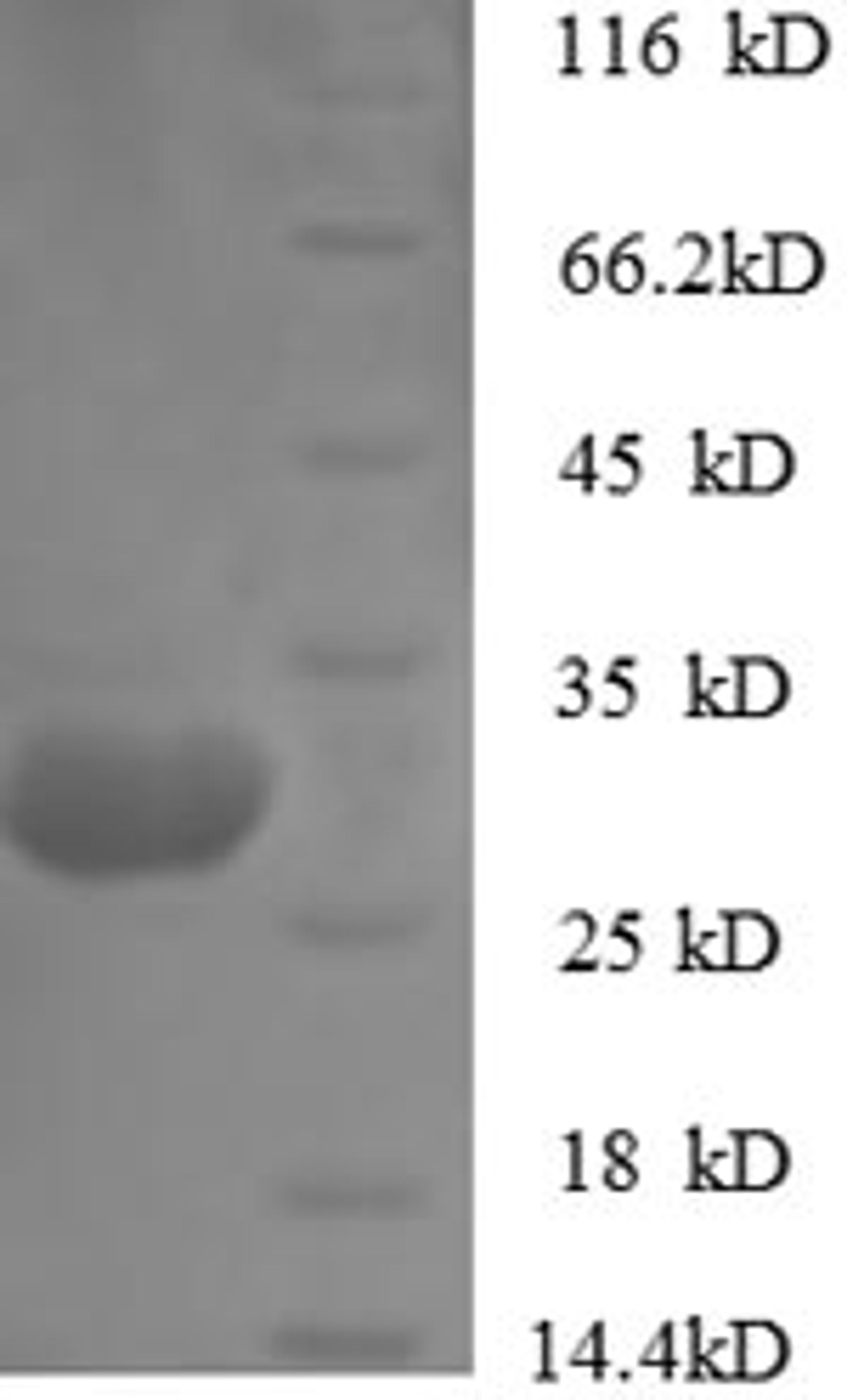 (Tris-Glycine gel) Discontinuous SDS-PAGE (reduced) with 5% enrichment gel and 15% separation gel.