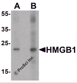 Western blot analysis of HMGB1 in human brain tissue lysate with HMGB1 antibody at (A) 1 and (B) 2 &#956;g/ml