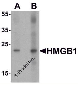 Western blot analysis of HMGB1 in human brain tissue lysate with HMGB1 antibody at (A) 1 and (B) 2 μg/ml
