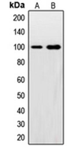 Western blot analysis of HeLa (Lane 1), U2OS (Lane 2) whole cell lysates using SNCAIP antibody