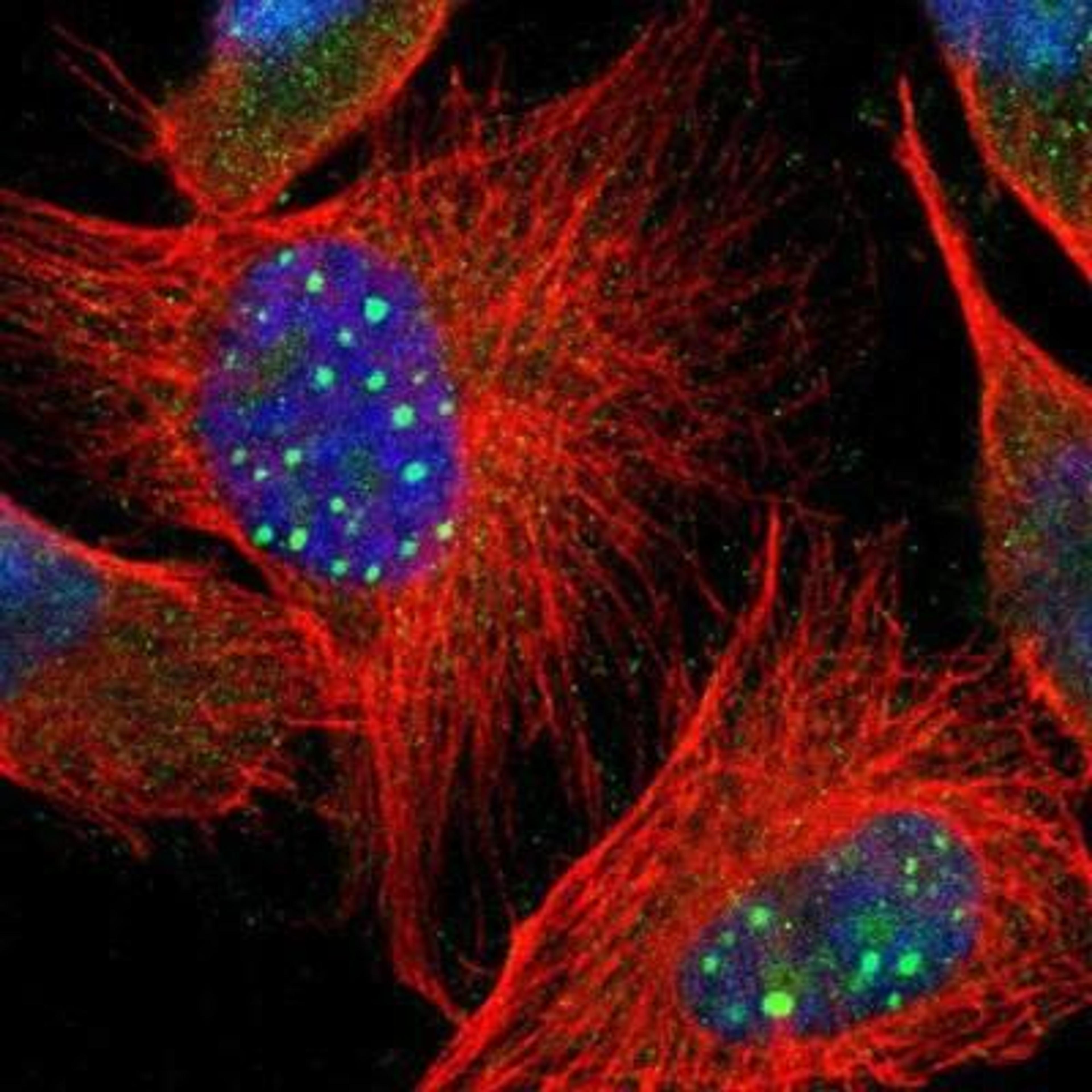 Immunocytochemistry/Immunofluorescence: BORIS Antibody [NBP1-89947] - Staining of human cell line U-251MG shows positivity in nucleus & cytoplasm.