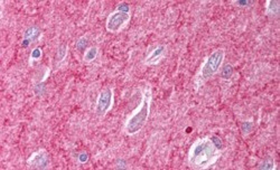 45-758 (2.5ug/ml) staining of paraffin embedded Human Brain (Cerebral Cortex). Steamed antigen retrieval with citrate buffer pH 6, AP-staining.