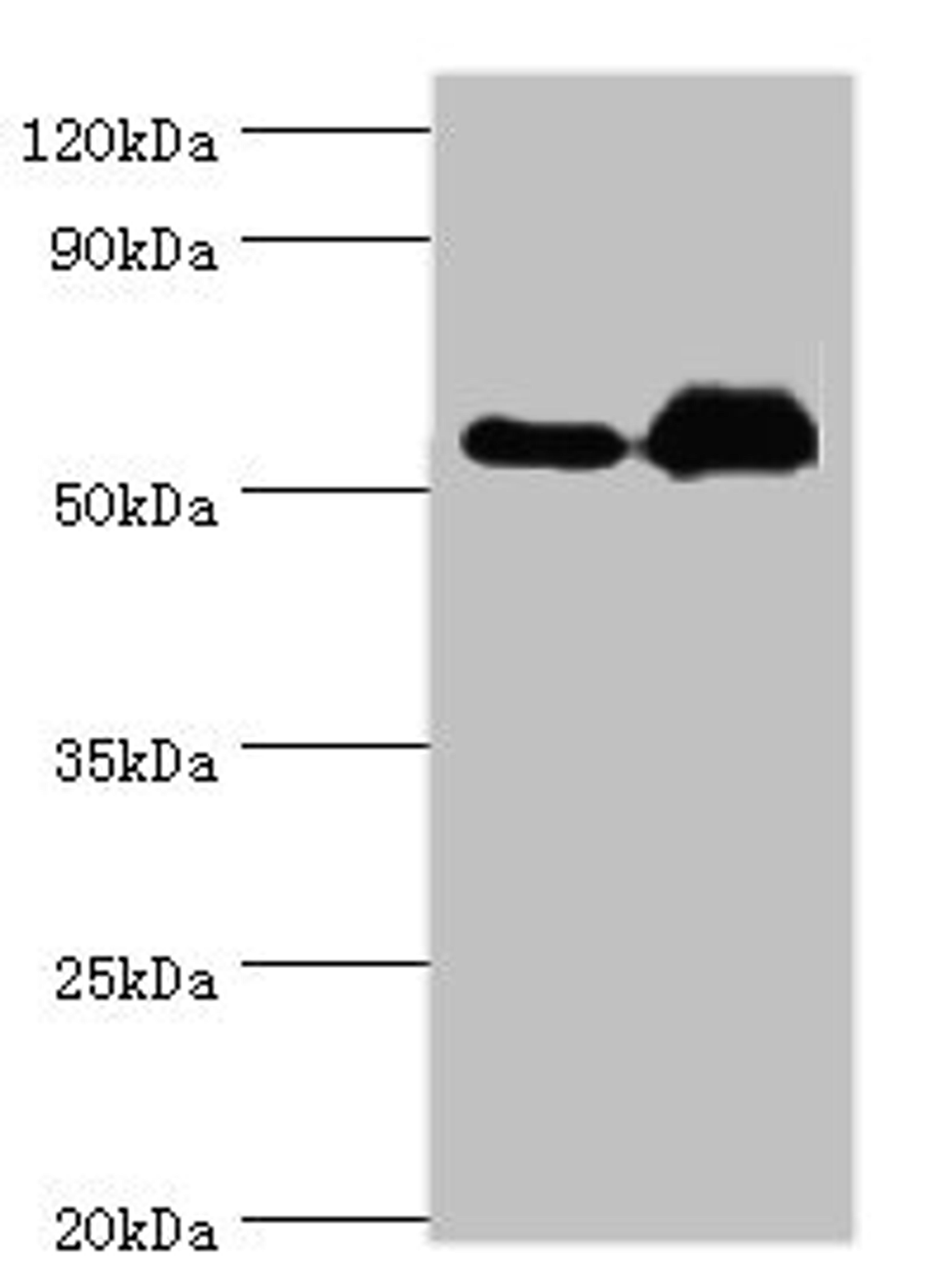 Western blot. All lanes: Retinal dehydrogenase 2 antibody at 9ug/ml. Lane 1: K562 whole cell lysate. Lane 2: Mouse liver tissue. Secondary. Goat polyclonal to rabbit IgG at 1/10000 dilution. Predicted band size: 57, 54, 55, 47 kDa. Observed band size: 57 kDa. 