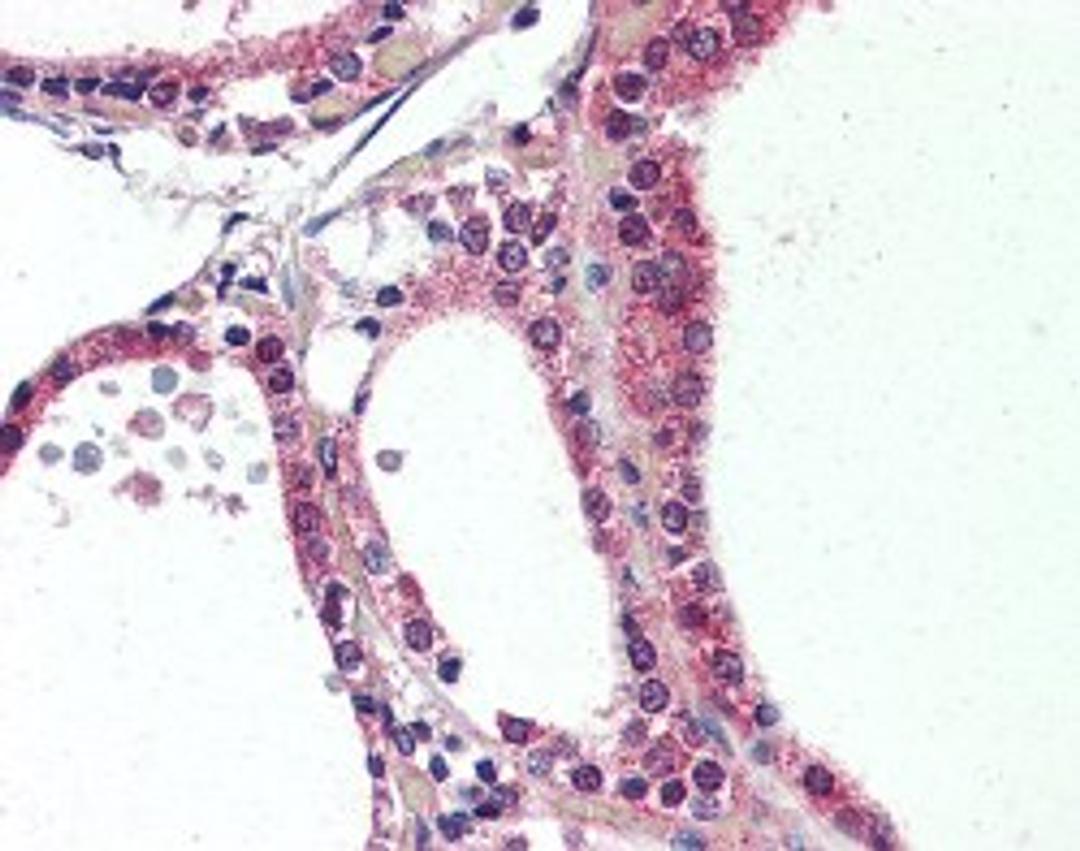 Immunohistochemistry staining of NR1D2 in human thyroid tissue using NR1D2 Antibody.