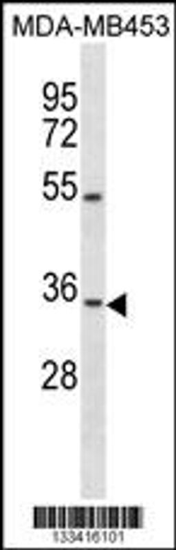 Western blot analysis in MDA-MB453 cell line lysates (35ug/lane).