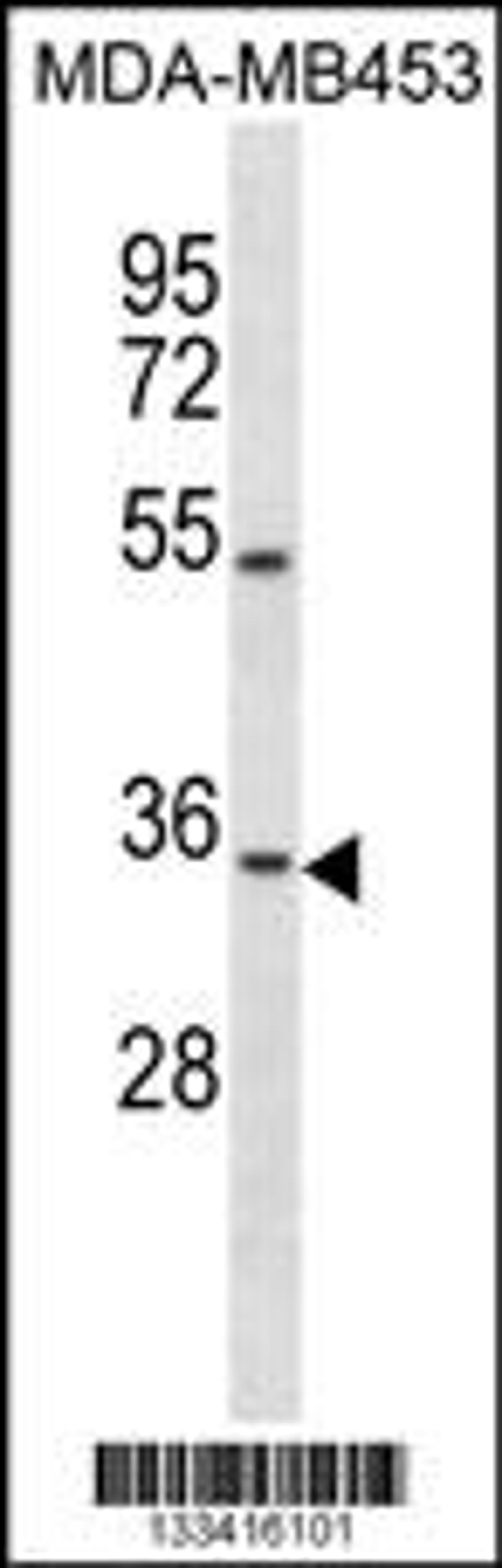 Western blot analysis in MDA-MB453 cell line lysates (35ug/lane).