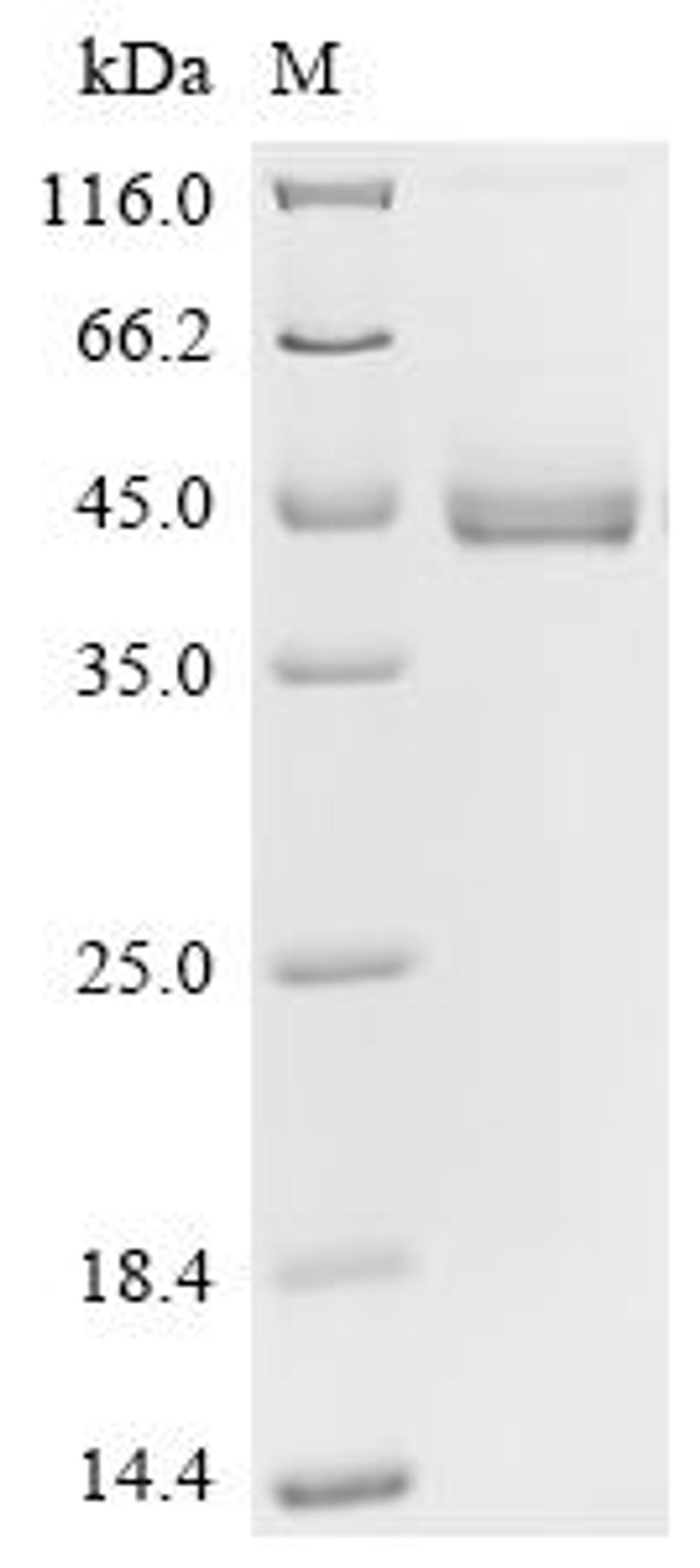 (Tris-Glycine gel) Discontinuous SDS-PAGE (reduced) with 5% enrichment gel and 15% separation gel.