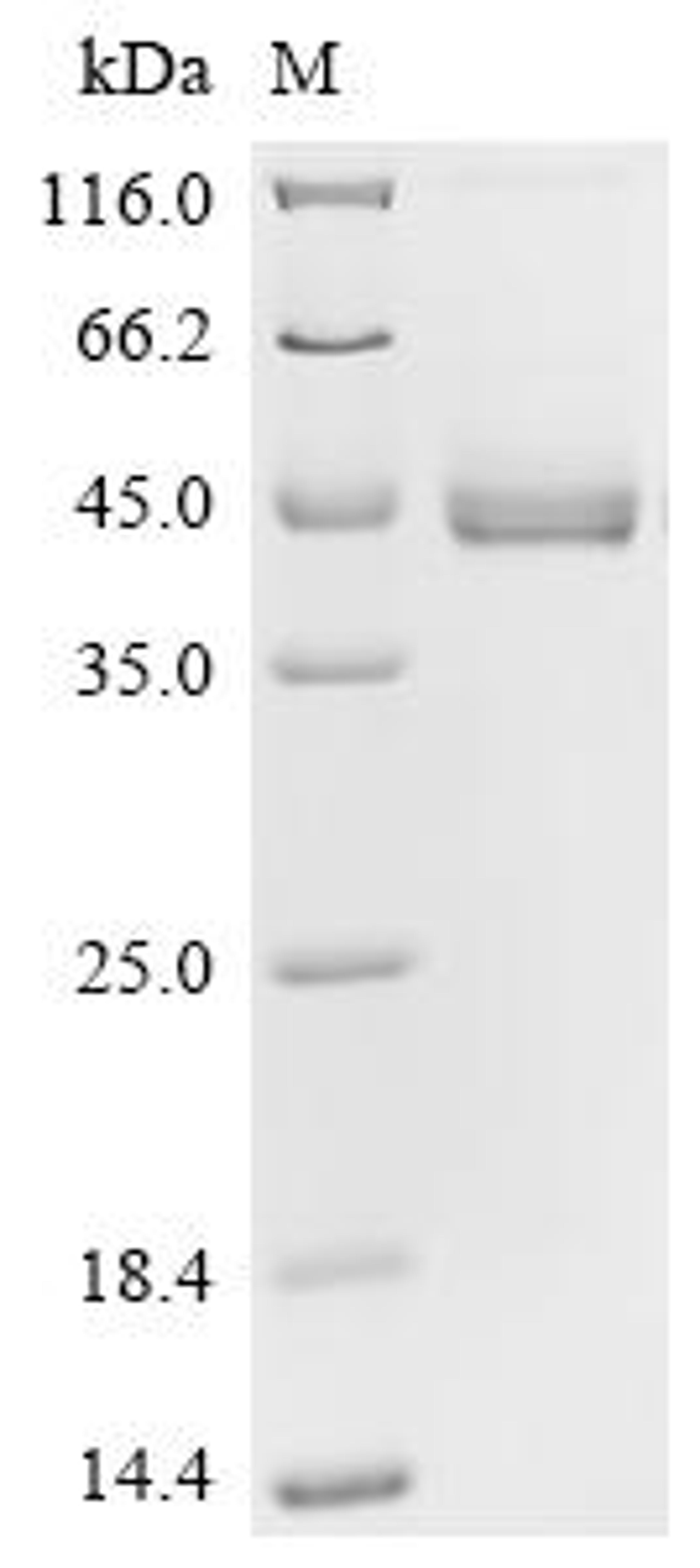 (Tris-Glycine gel) Discontinuous SDS-PAGE (reduced) with 5% enrichment gel and 15% separation gel.