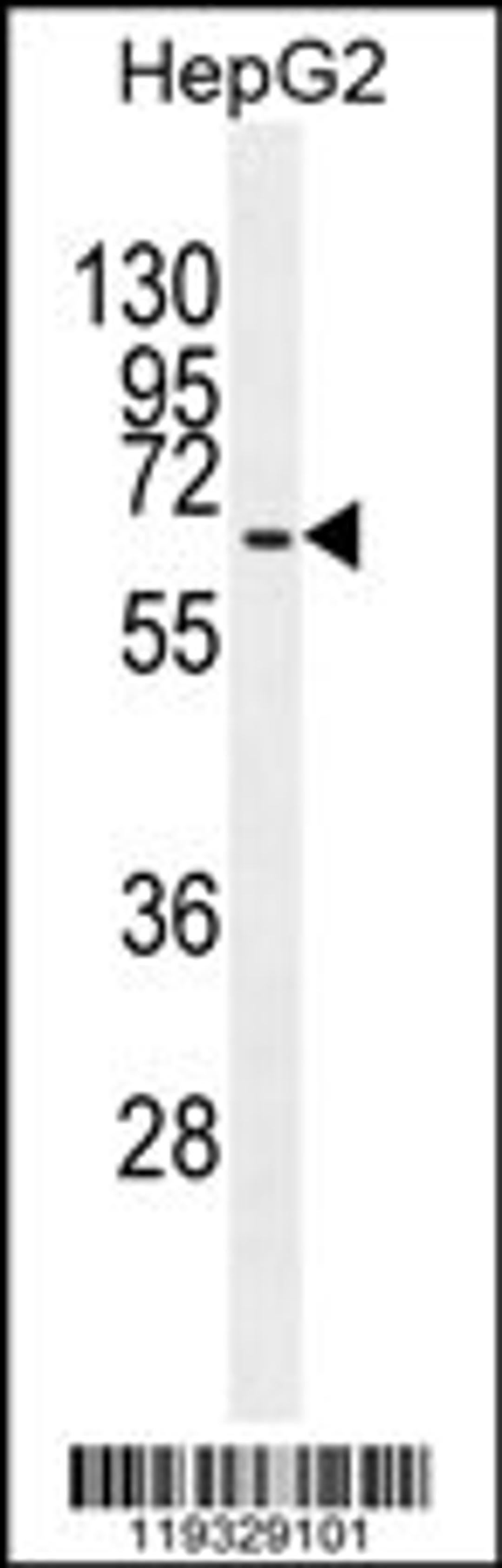 Western blot analysis in HepG2 cell line lysates (35ug/lane).