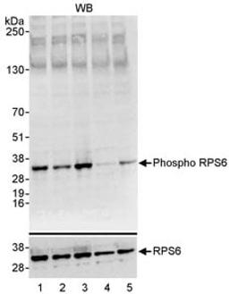 Detection of human Phospho RPS6 (S235/S236) by western blot.