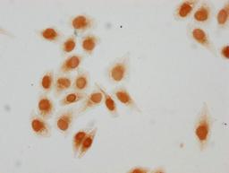 Immunocytochemistry analysis of CSB-PA010389PA15acHU diluted at 1:10 and staining in Hela cells(treated with 30mM sodium butyrate for 4h) performed on a Leica BondTM system. The cells were fixed in 4% formaldehyde, permeabilized using 0.2% Triton X-100 and blocked with 10% normal goat serum 30min at RT. Then primary antibody (1% BSA) was incubated at 4°C overnight. The primary is detected by a biotinylated secondary antibody and visualized using an HRP conjugated SP system.