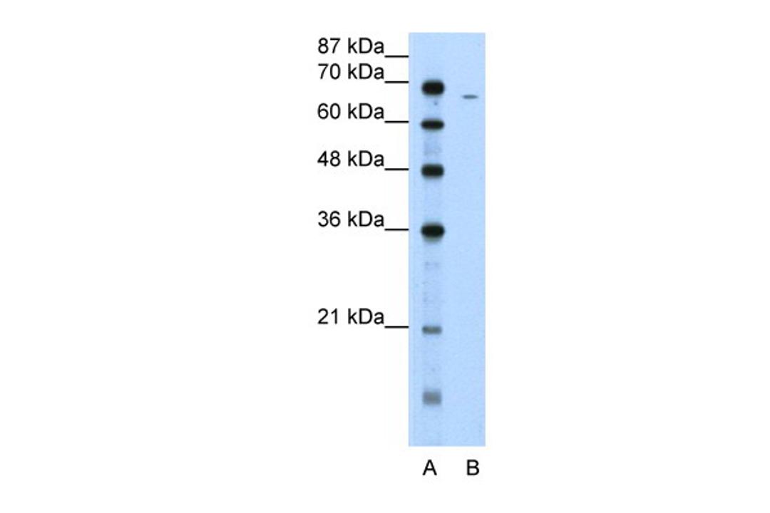 Antibody used in WB on Human Jurkat 5.0 ug/ml.