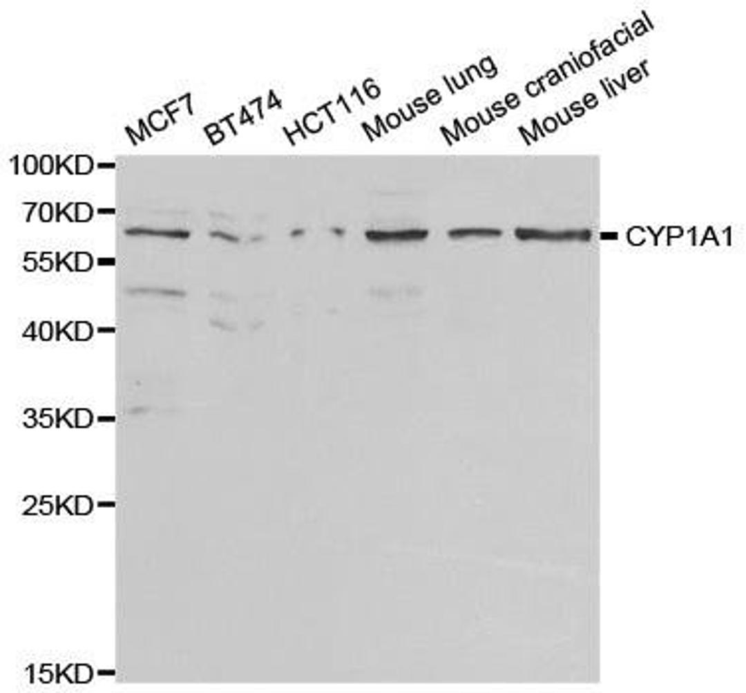 Western blot analysis of extracts of various cell lines using CYP1A1 antibody