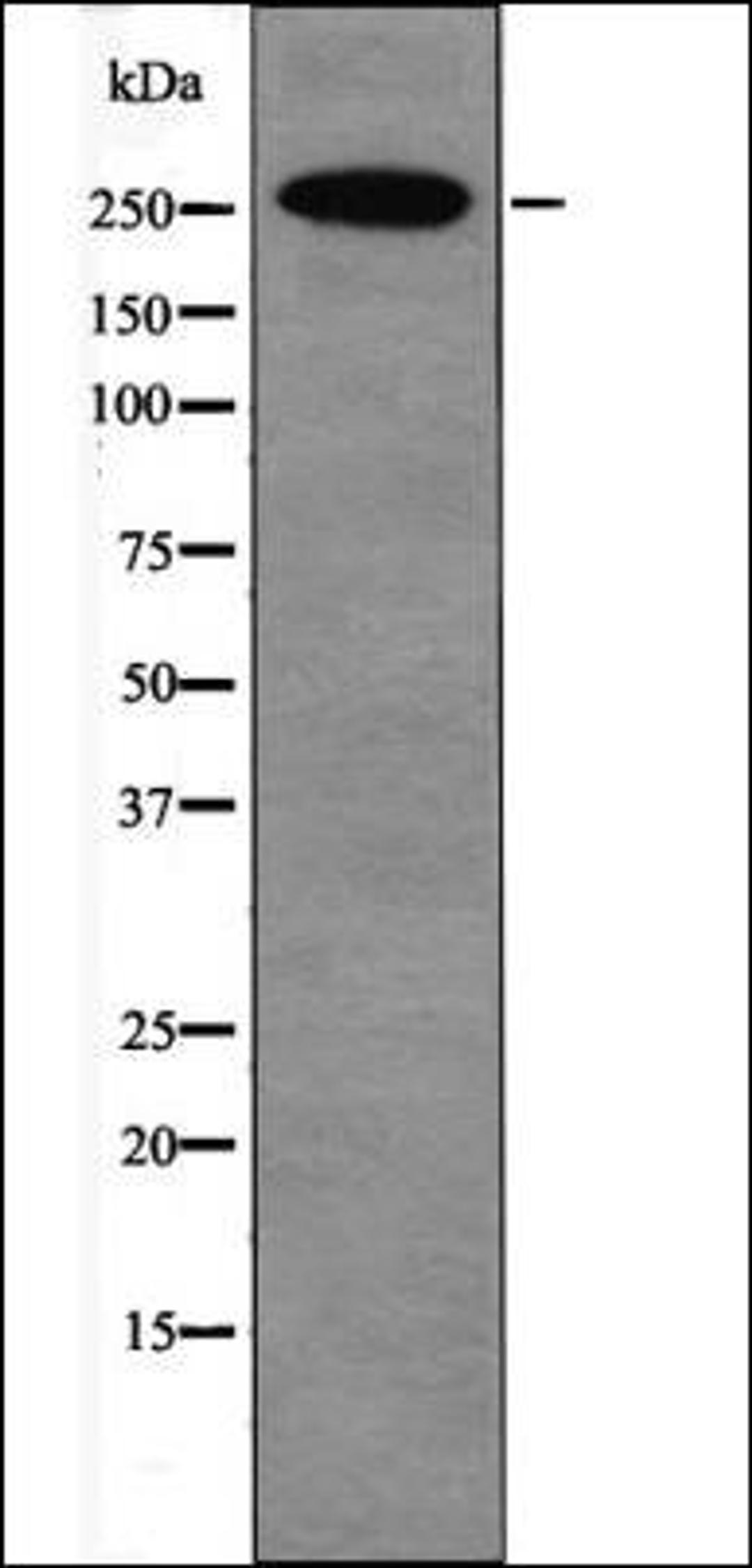 Western blot analysis of PMA treated HeLa whole cell lysates using E1A-associated Protein p300 -Phospho-Ser1834- antibody