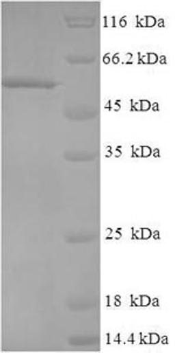 (Tris-Glycine gel) Discontinuous SDS-PAGE (reduced) with 5% enrichment gel and 15% separation gel.