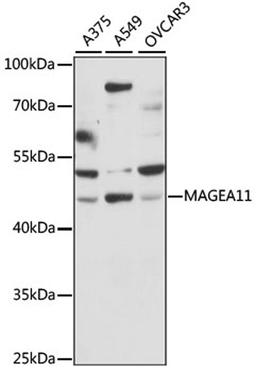 Western blot - MAGEA11 antibody (A15288)