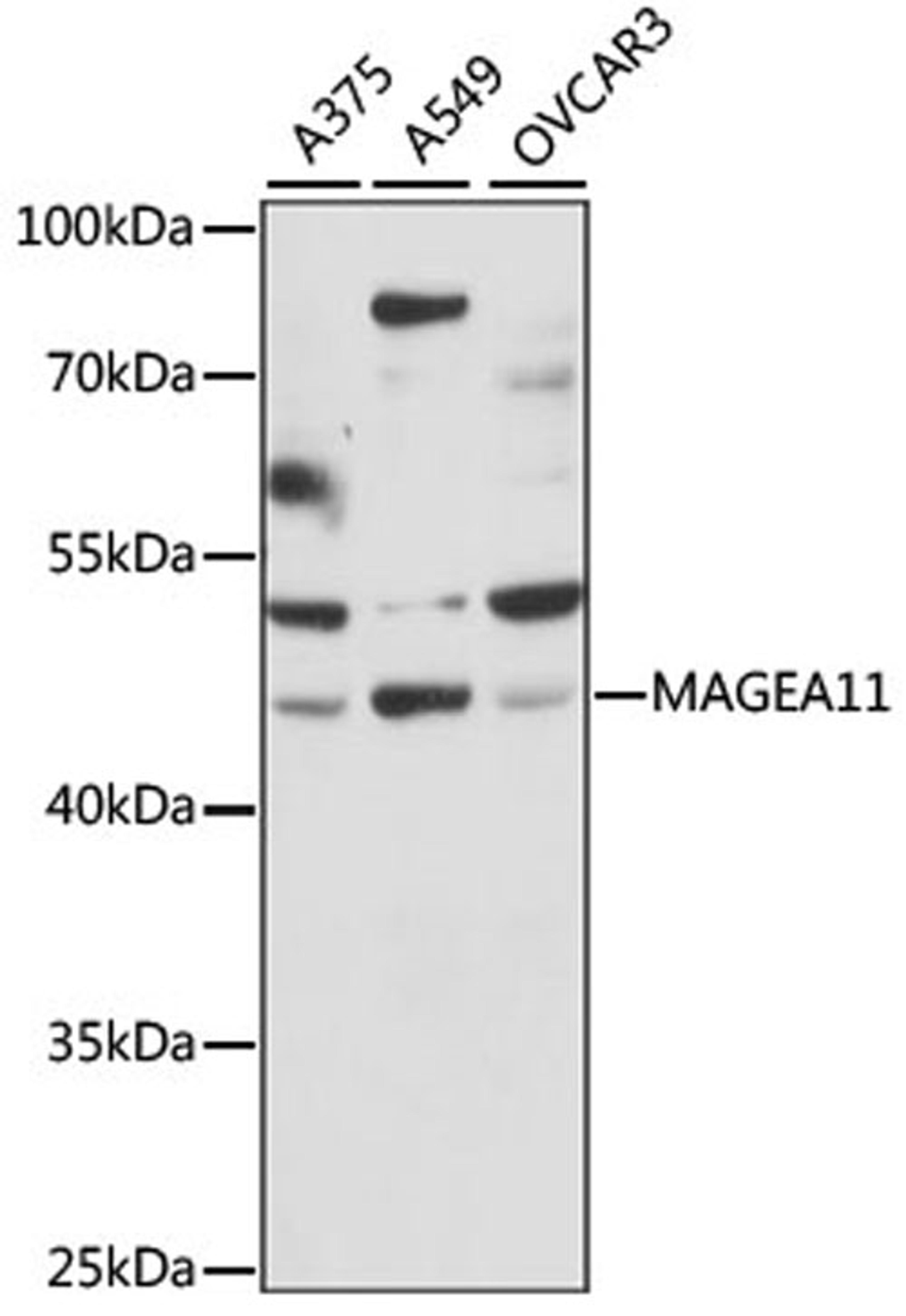 Western blot - MAGEA11 antibody (A15288)