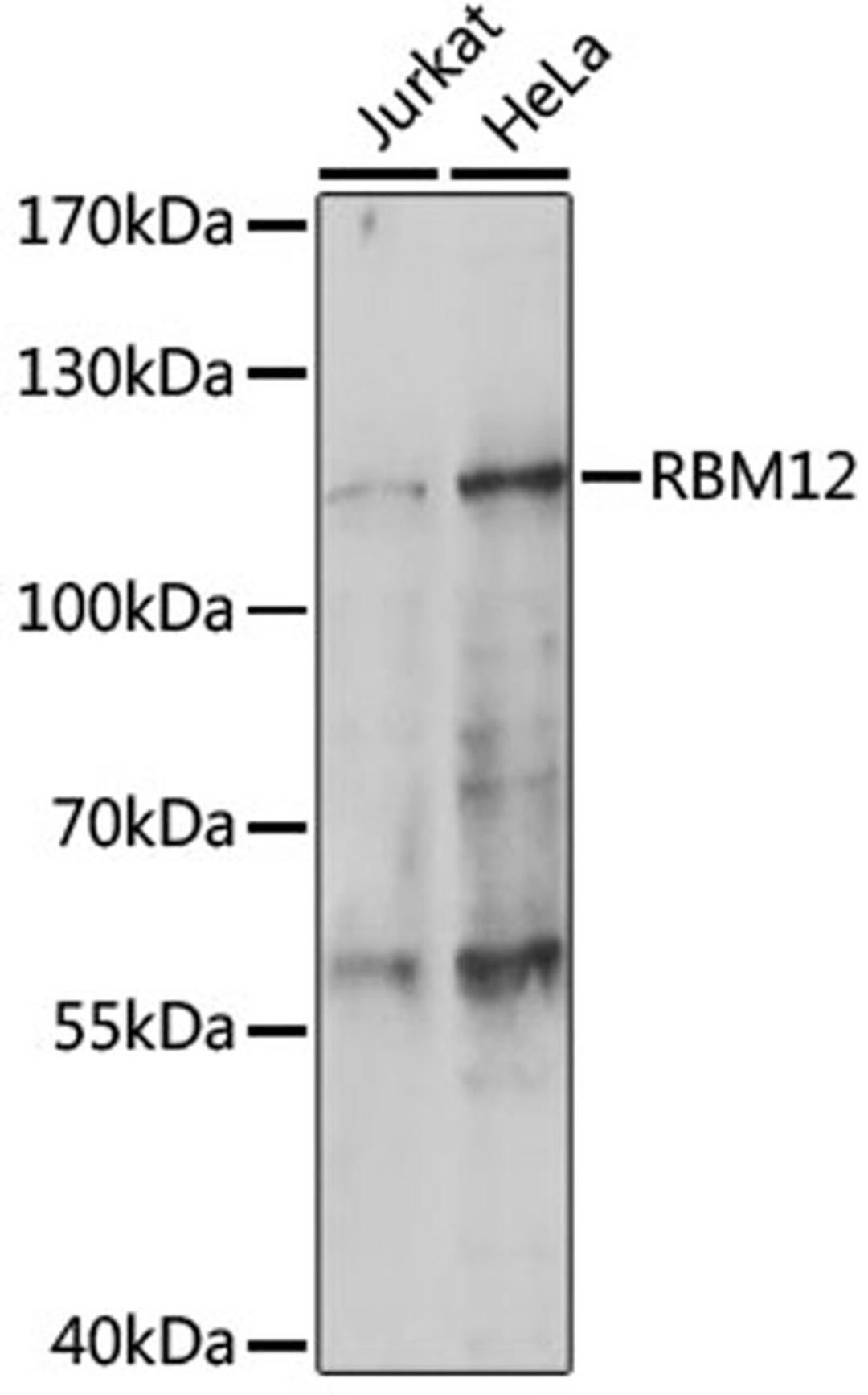 Western blot - RBM12 antibody (A14683)